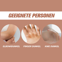 Laden Sie das Bild in den Galerie-Viewer, Melanin-Entfernung Aufhellende Creme