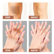 Laden Sie das Bild in den Galerie-Viewer, Melanin-Entfernung Aufhellende Creme