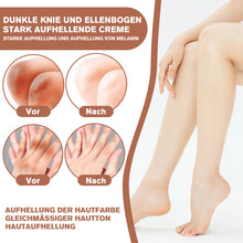 Laden Sie das Bild in den Galerie-Viewer, Melanin-Entfernung Aufhellende Creme