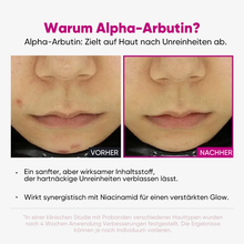 Laden Sie das Bild in den Galerie-Viewer, Intensives Aufhellungsserum