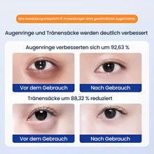 Laden Sie das Bild in den Galerie-Viewer, Straffendes Pflaster gegen Tränensäcke und Augenringe