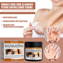 Laden Sie das Bild in den Galerie-Viewer, Effektive Gelenkaufhellungscreme