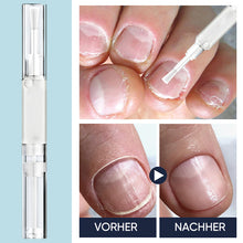 Laden Sie das Bild in den Galerie-Viewer, Antibakterieller Nagellackstift