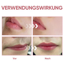 Laden Sie das Bild in den Galerie-Viewer, Spray zur Haarentfernung im Gesicht