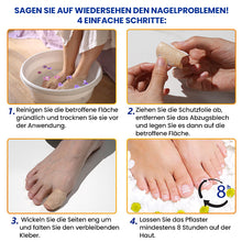 Laden Sie das Bild in den Galerie-Viewer, Ultradünne Nagelpilz-Sticker