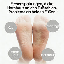 Laden Sie das Bild in den Galerie-Viewer, Elektrischer Fußfeilen für den Hausgebrauch