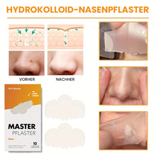 Laden Sie das Bild in den Galerie-Viewer, Hydrokolloid-Nasenpflaster für Porenreinigung, 10 Stück