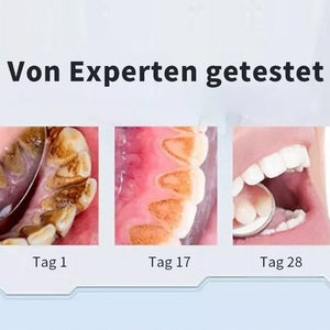 🔥Probiotische Zahnpasta mit 6 Probiotika oalance Oral Microbiota Strength