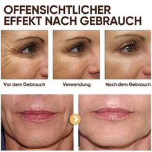 Laden Sie das Bild in den Galerie-Viewer, Retinol Anti-Falten-Gesichtscreme