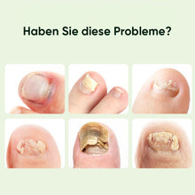 Laden Sie das Bild in den Galerie-Viewer, Nagelreparatur-Magie-Tropfen