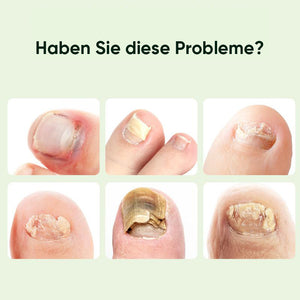 Nagelreparatur-Magie-Tropfen