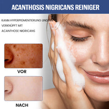 Laden Sie das Bild in den Galerie-Viewer, Aufhellender Niacinamid-Reiniger