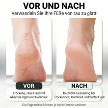 Laden Sie das Bild in den Galerie-Viewer, Elektrischer Fußfeilen für den Hausgebrauch