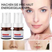 Laden Sie das Bild in den Galerie-Viewer, Aufhellende Gesichtscreme gegen Sommersprossen mit Vitamin C