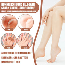 Laden Sie das Bild in den Galerie-Viewer, Effektive Gelenkaufhellungscreme