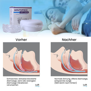 Verstellbare Zahnspangen gegen Schnarchen