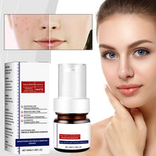 Laden Sie das Bild in den Galerie-Viewer, Aufhellende Gesichtscreme gegen Sommersprossen mit Vitamin C
