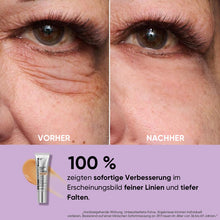 Laden Sie das Bild in den Galerie-Viewer, Temporärer Augenstraffer