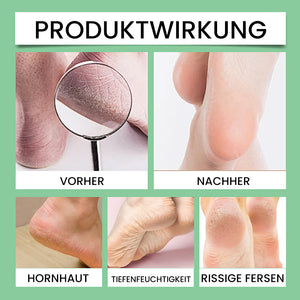 Hornhautentferner für die Füße