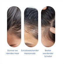 Laden Sie das Bild in den Galerie-Viewer, Hochwirksames Haarwachstums-Roll-On-Serum