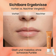 Laden Sie das Bild in den Galerie-Viewer, Sanfte Gesichts-Haarentfernungscreme