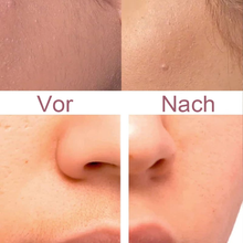 Laden Sie das Bild in den Galerie-Viewer, Gesichtsepilierer