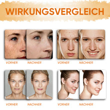 Laden Sie das Bild in den Galerie-Viewer, Zitronen-Kurkuma-Kojic-Säure-Seife