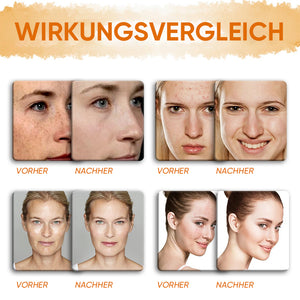Zitronen-Kurkuma-Kojic-Säure-Seife