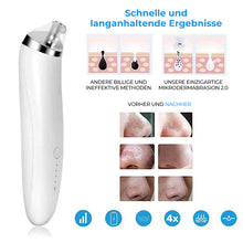 Laden Sie das Bild in den Galerie-Viewer, Mitesser-Reinigungsgerät