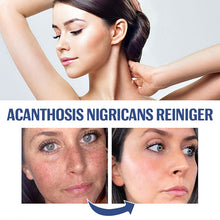Laden Sie das Bild in den Galerie-Viewer, Aufhellender Niacinamid-Reiniger