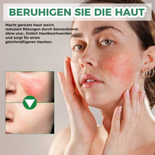 Laden Sie das Bild in den Galerie-Viewer, Farbkorrigierende Behandlungscreme