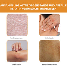 Laden Sie das Bild in den Galerie-Viewer, Aufhellendes Peeling-Gel