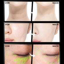 Laden Sie das Bild in den Galerie-Viewer, Straffungsgerät für die Gesichtsmassage mit drei Funktionen