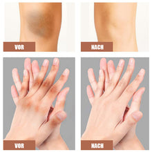 Laden Sie das Bild in den Galerie-Viewer, Effektive Gelenkaufhellungscreme