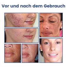 Laden Sie das Bild in den Galerie-Viewer, Aufhellender Niacinamid-Reiniger