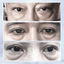 Laden Sie das Bild in den Galerie-Viewer, Straffendes Pflaster gegen Tränensäcke und Augenringe