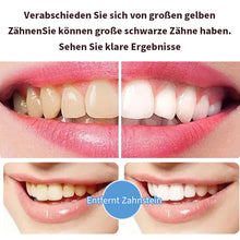 Laden Sie das Bild in den Galerie-Viewer, 🔥Probiotische Zahnpasta mit 6 Probiotika oalance Oral Microbiota Strength