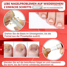 Laden Sie das Bild in den Galerie-Viewer, Nagelpilz-Stift