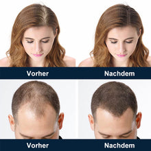 Laden Sie das Bild in den Galerie-Viewer, Kopfhautpflege-Haarwuchsspray