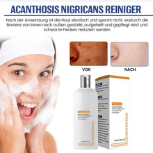 Laden Sie das Bild in den Galerie-Viewer, Aufhellender Niacinamid-Reiniger