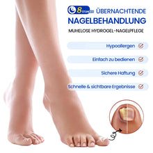 Laden Sie das Bild in den Galerie-Viewer, Ultradünne Nagelpilz-Sticker