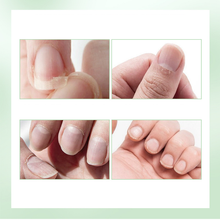 Laden Sie das Bild in den Galerie-Viewer, Öl zur Pflege der Nägel