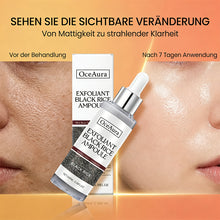 Laden Sie das Bild in den Galerie-Viewer, Schwarzer &amp; Weißer Reis Peeling-Serum