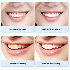 🔥Probiotische Zahnpasta mit 6 Probiotika oalance Oral Microbiota Strength