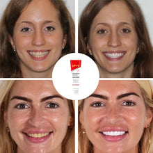 Laden Sie das Bild in den Galerie-Viewer, 🔥Probiotische Zahnpasta mit 6 Probiotika oalance Oral Microbiota Strength