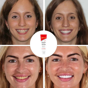 🔥Probiotische Zahnpasta mit 6 Probiotika oalance Oral Microbiota Strength