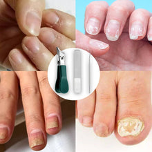 Laden Sie das Bild in den Galerie-Viewer, Premium 3-teiliges Set mit Nagelknipsern im Adlerkrallen-Design
