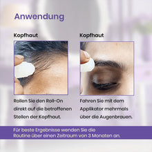 Laden Sie das Bild in den Galerie-Viewer, Hochwirksames Haarwachstums-Roll-On-Serum