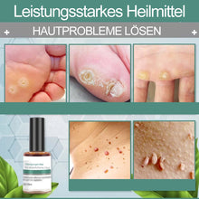 Laden Sie das Bild in den Galerie-Viewer, Reinigungsmittel für abgestorbene Haut