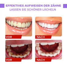 Laden Sie das Bild in den Galerie-Viewer, Aufhellende Zahnpasta